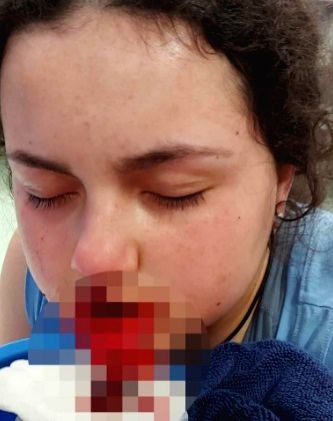 12-year-old girl horrifically mauled by pet dog in Australia